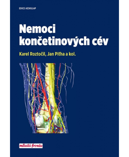 Nemoci končetinových cév