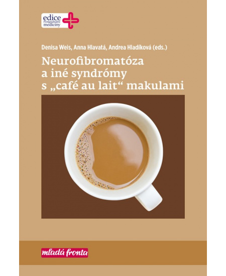 Neurofibromatóza a iné syndromy s „café au lait“ makulami Mladá fronta