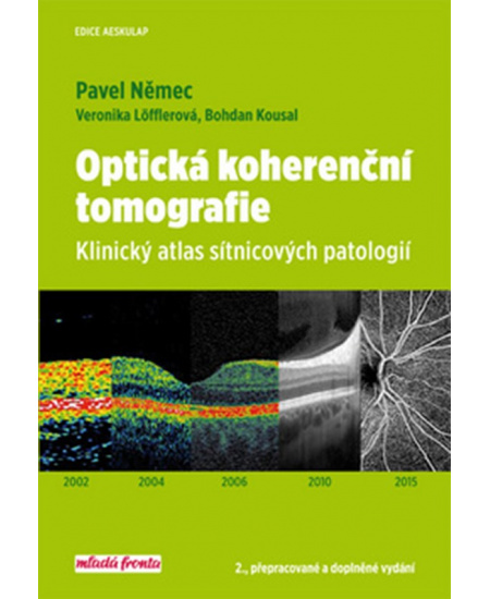 Optická kohereční tomografie