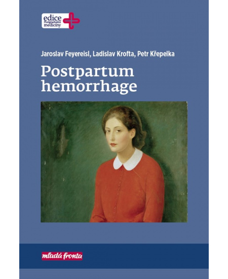 Postpartum hemorrhage
