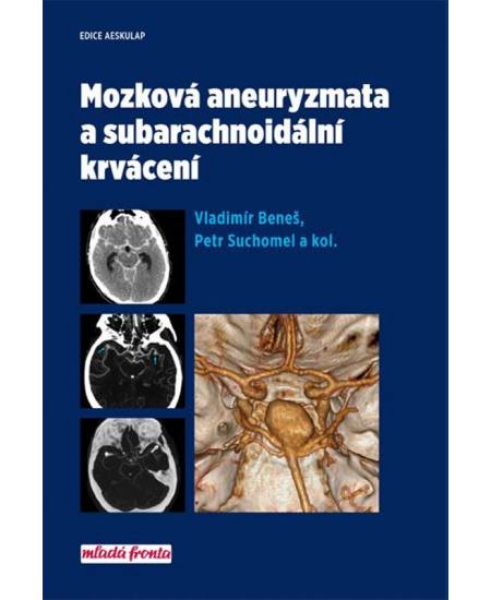 Mozková aneurysmata a subarachnoidální krvácení