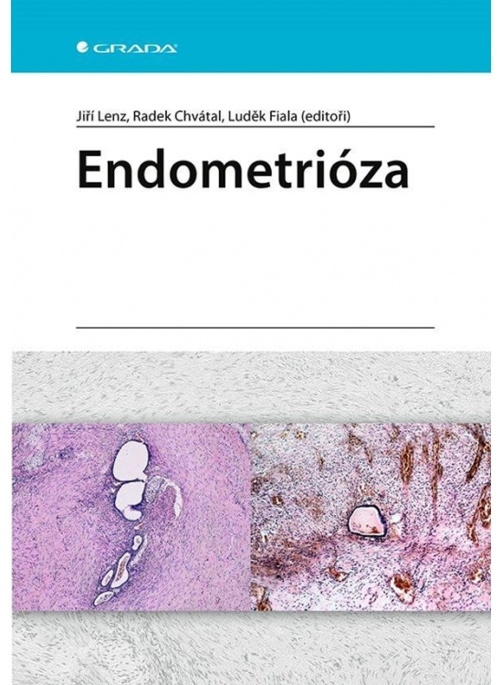 Endometrióza GRADA Publishing, a. s.