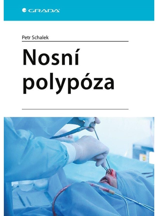 Nosní polypóza GRADA Publishing, a. s.