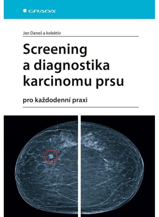 Screening a diagnostika karcinomu prsu pro každodenní praxi GRADA Publishing, a. s.