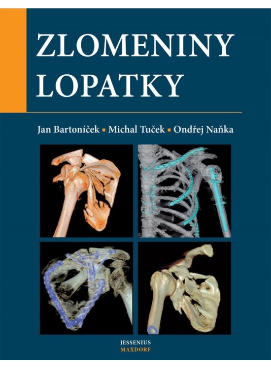 Zlomeniny lopatky
