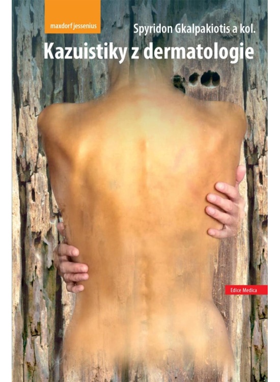 Kazuistiky z dermatologie Maxdorf s.r.o.