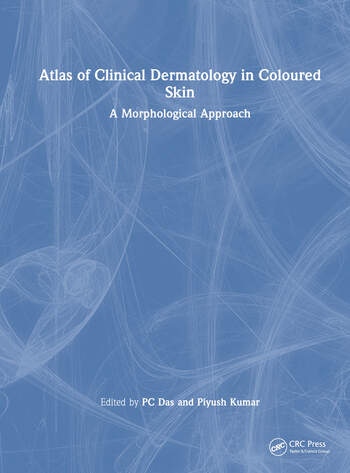 Atlas of Clinical Dermatology in Coloured Skin Taylor & Francis Ltd