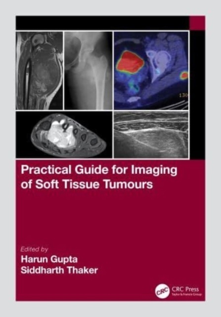 Practical Guide for Imaging of Soft Tissue Tumours Taylor & Francis Ltd