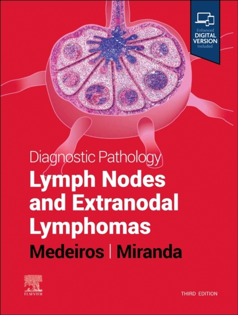 Diagnostic Pathology: Lymph Nodes and Extranodal Lymphomas, 3rd Edition Elsevier
