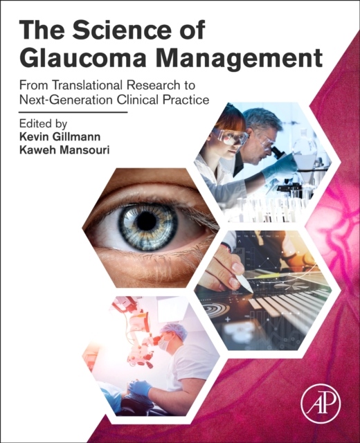 The Science of Glaucoma Management, From Translational Research to Next-Generation Clinical Practice Elsevier