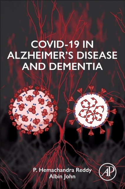 COVID-19 in Alzheimer´s Disease and Dementia