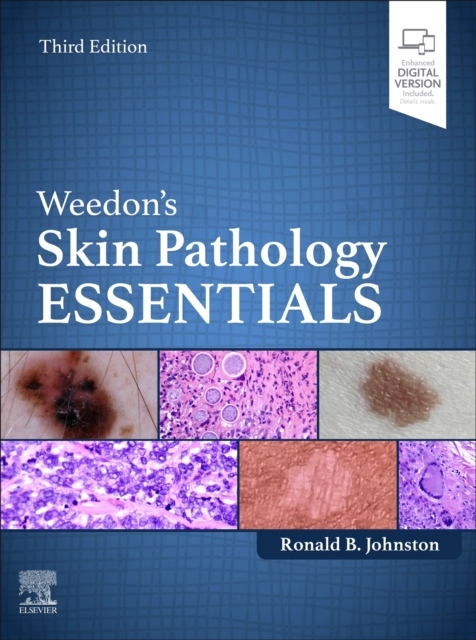 Weedon´s Skin Pathology Essentials, 3rd Edition Elsevier