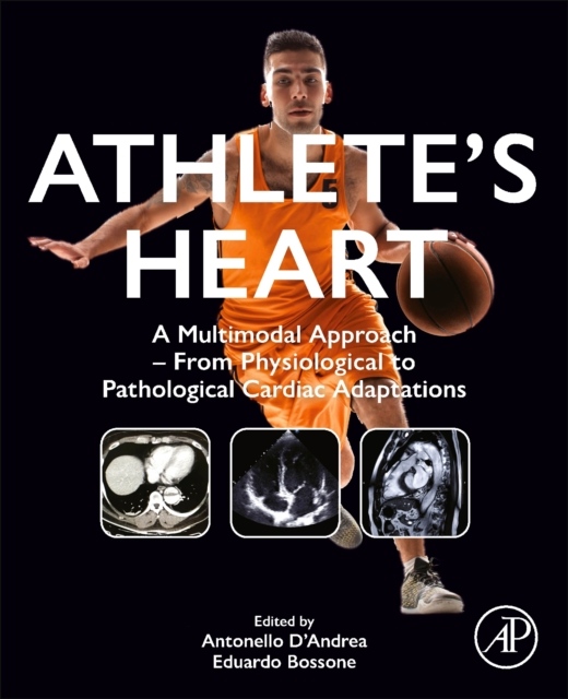 Athlete´s Heart, A Multimodal Approach - From Physiological to Pathological Cardiac Adaptations Elsevier