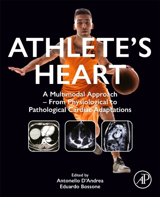 Athlete´s Heart, A Multimodal Approach - From Physiological to Pathological Cardiac Adaptations