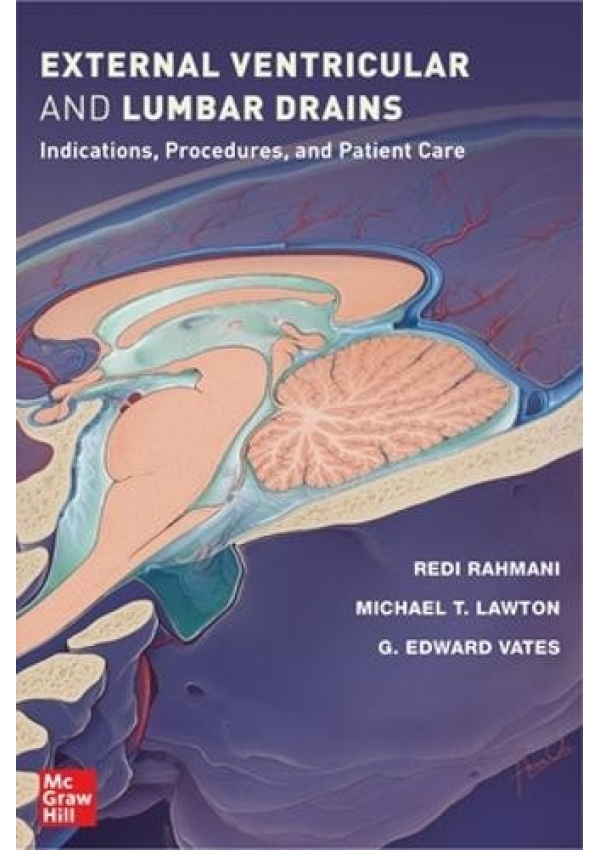 External Ventricular and Lumbar Drains: Indications, Procedures, and Patient Care
