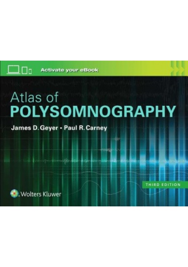 Atlas of Polysomnography