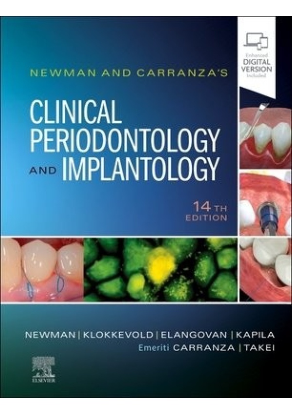 Newman and Carranza's Clinical Periodontology and Implantology
