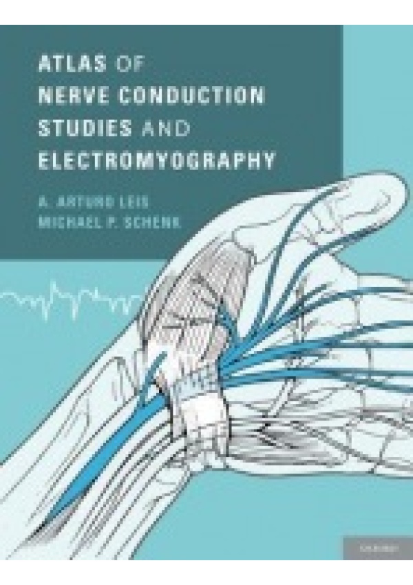 Atlas of Nerve Conduction Studies and Electromyography