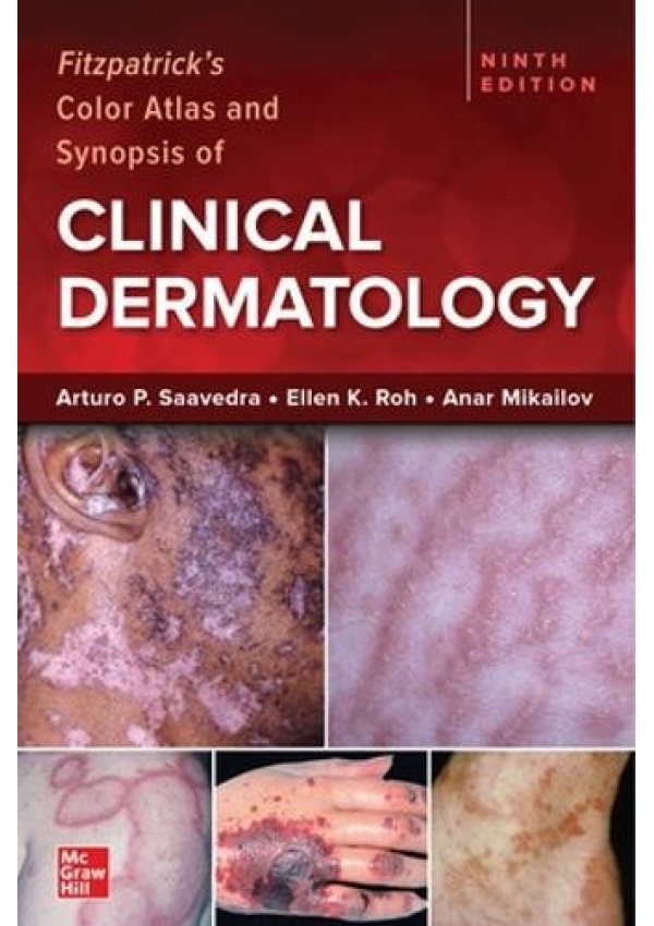 Fitzpatrick's Color Atlas and Synopsis of Clinical Dermatology, Ninth Edition