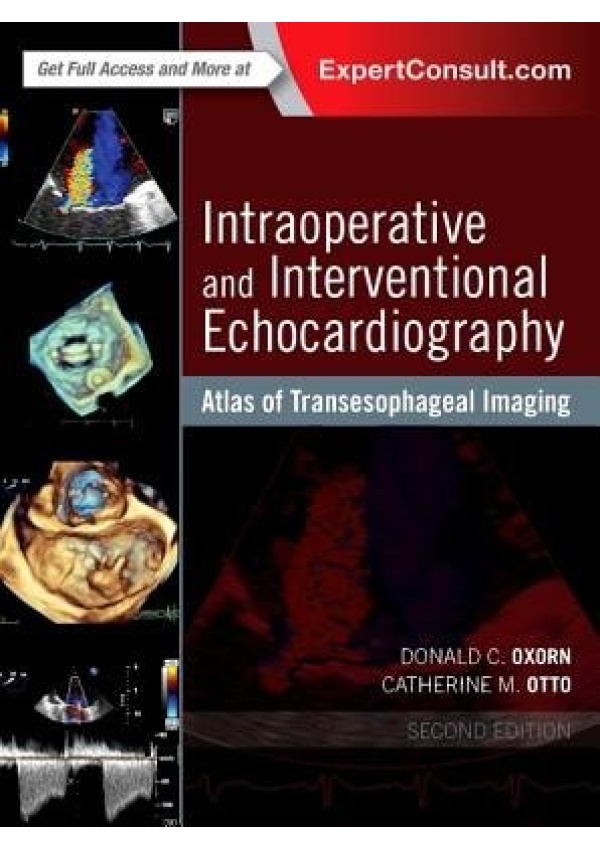 Intraoperative and Interventional Echocardiography, Atlas of Transesophageal Imaging