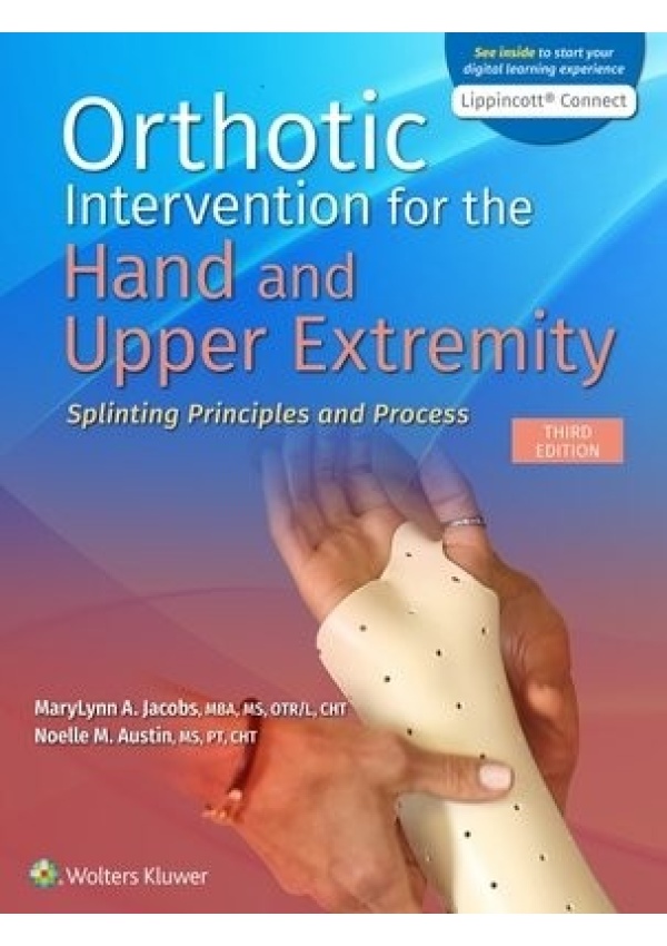 Orthotic Intervention for the Hand and Upper Extremity, Splinting Principles and Process