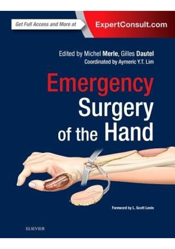 Emergency Surgery of the Hand