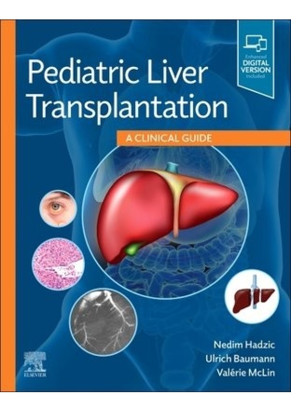 Pediatric Liver Transplantation, A Clinical Guide