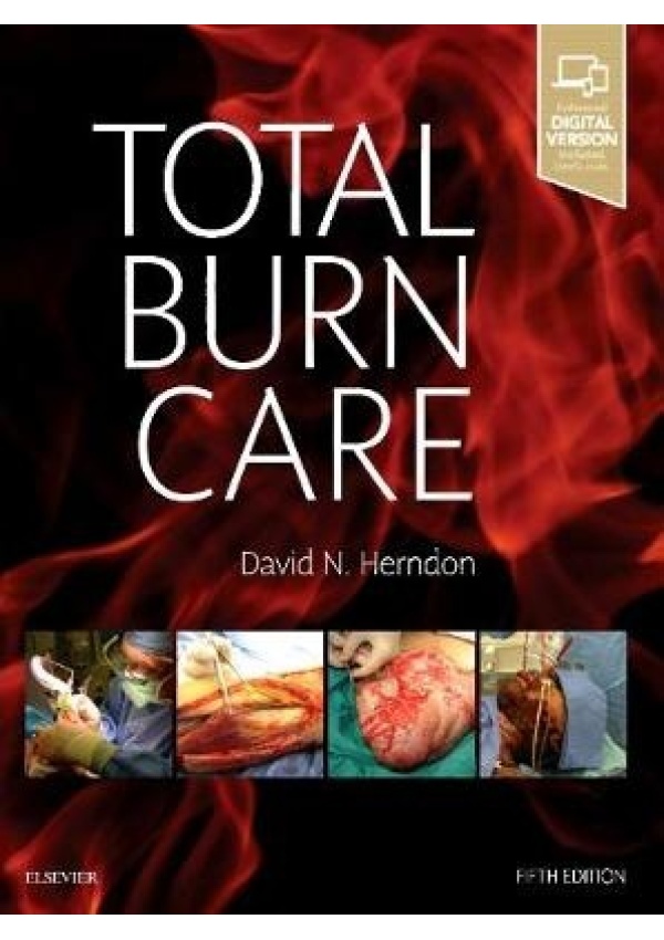 Total Burn Care