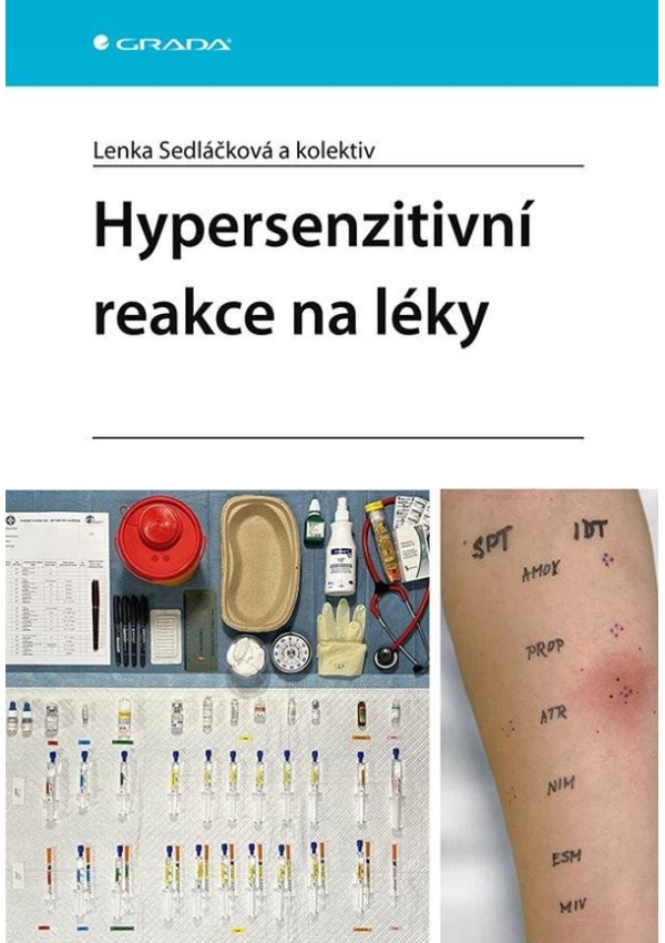 Hypersenzitivní reakce na léky