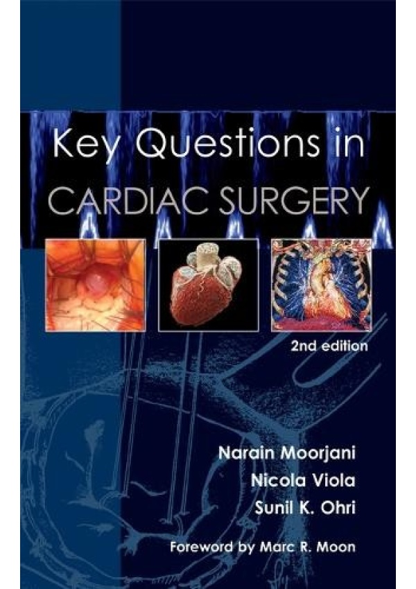 Key Questions in Cardiac Surgery