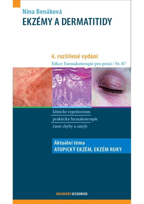 Ekzémy a dermatitidy