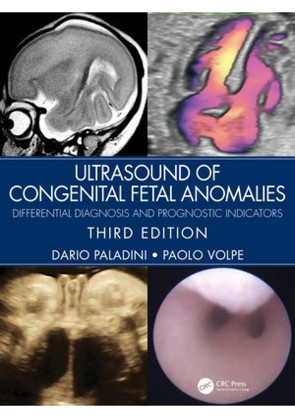 Ultrasound of Congenital Fetal Anomalies, Differential Diagnosis and Prognostic Indicators