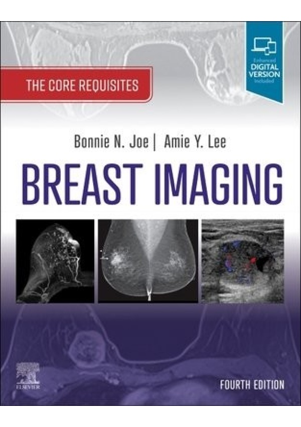 Breast Imaging, The Core Requisites