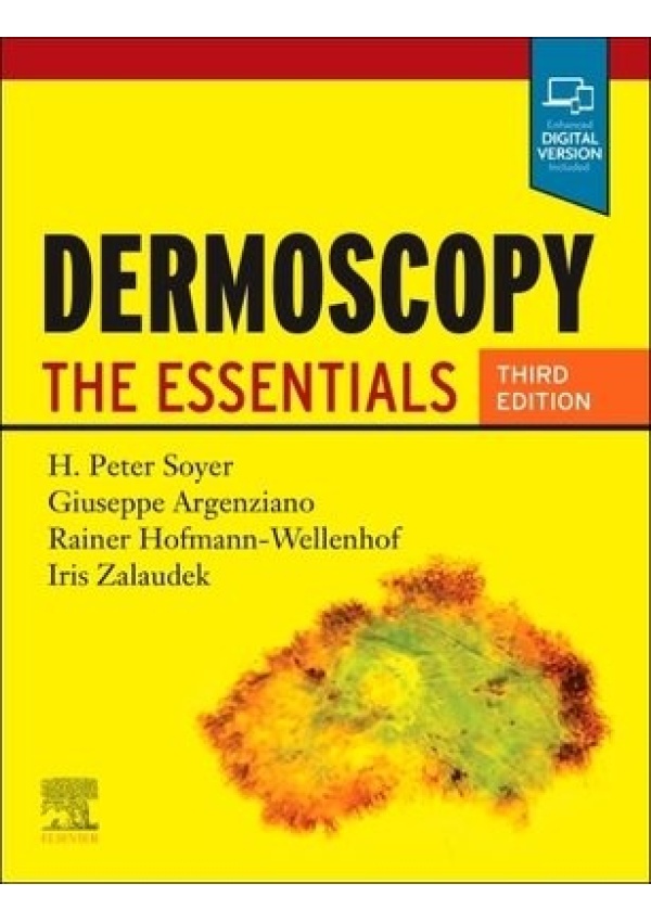 Dermoscopy, The Essentials