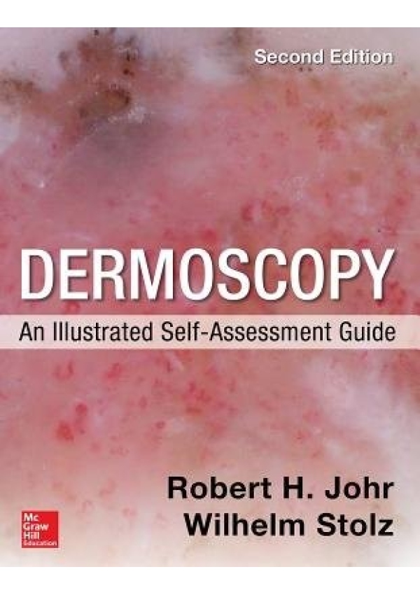 Dermoscopy: An Illustrated Self-Assessment Guide, 2/e