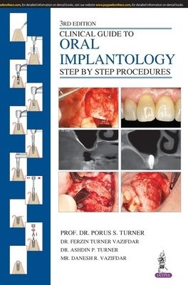 Clinical Guide to Oral Implantology, Step by Step Procedures