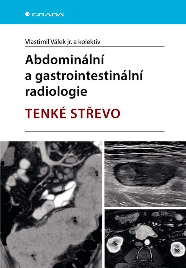Abdominální a gastrointestinální radiologie - Tenké střevo
