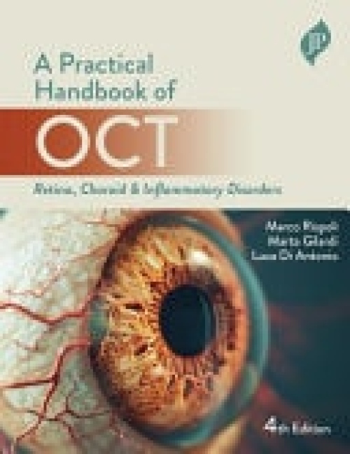 Practical Handbook of OCT, Retina, Choroid a Inflammatory Disorders