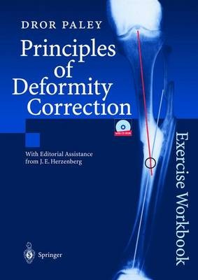 Principles of Deformity Correction, Exercise Workbook
