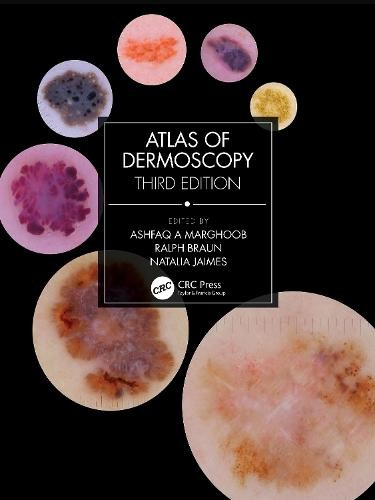 Atlas of Dermoscopy, Third Edition